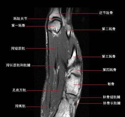 以咩咩启示录为例，详解骨骰规则（探究骨骰规则对游戏体验的影响）